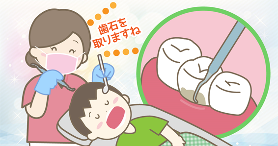 歯石とり 歯石とり