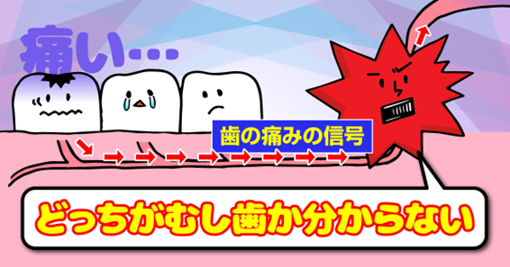 どっちがむし歯か分からない