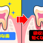レントゲンでわかる隠された病気②