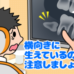 レントゲンでわかる隠された病気④