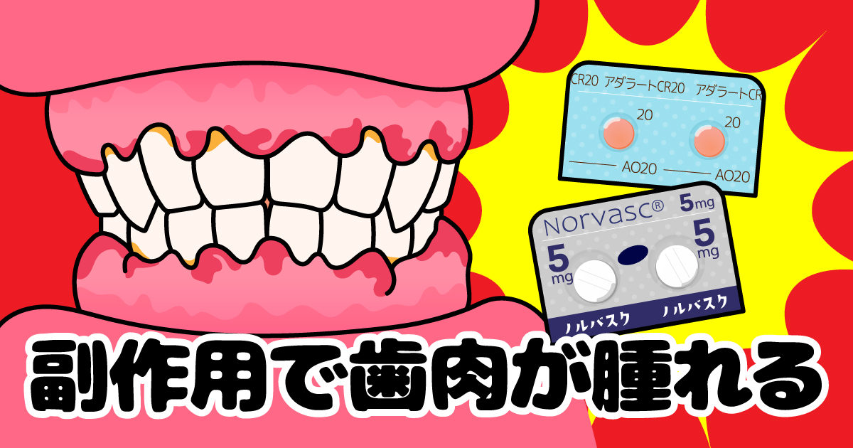 副作用で歯肉が腫れる