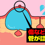 子供に多いお口の病気・・・その３