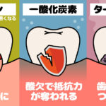 タバコと歯周病の関係その３