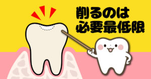 保険でできる白い詰め物（CR）とは③