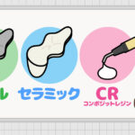 保険でできる白い詰め物（CR）とは④