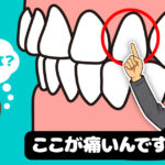 歯の痛みの意外な落とし穴シリーズ④