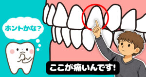 歯の痛みの意外な落とし穴シリーズ④