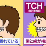 話題のスマホで顎関節症になる　その２