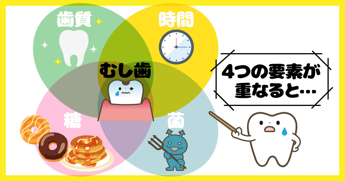 子供の歯を守る虫歯の４要素