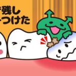 子供の歯を守る虫歯の4要素その4