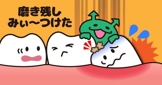 磨き残しみつけた