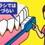 歯肉が下がったら要注意 その3