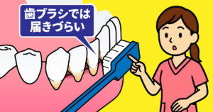 歯肉が下がったら要注意　その３
