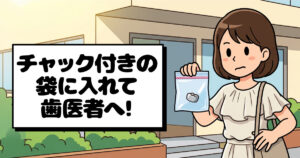 つめもの・かぶせ物の寿命と原因その４